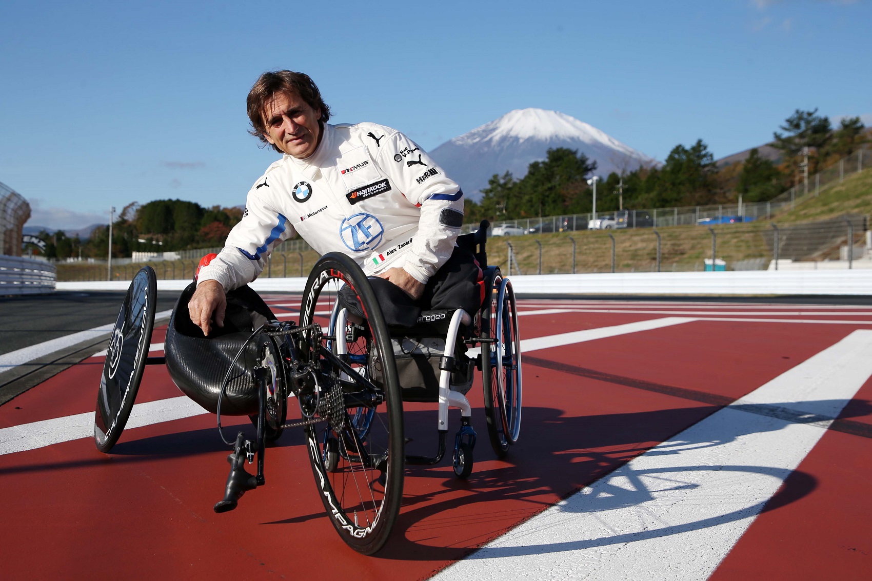 Alex Zanardi mindkét szemére megvakulhat?